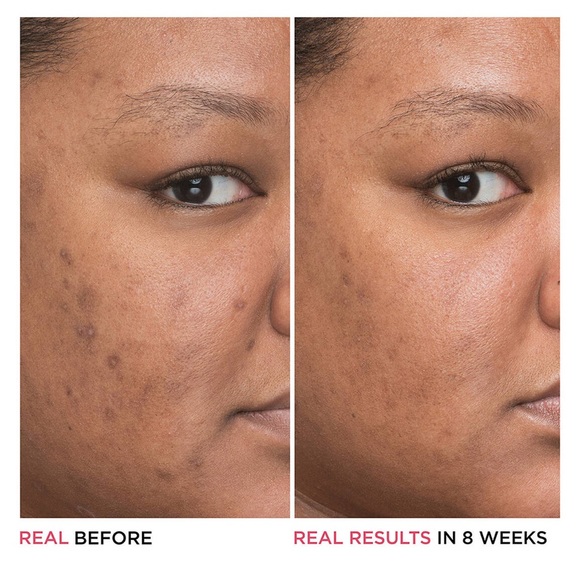 NEVER USED, it Cosmetics bye bye dark spots niacinamide serum - Picture 8 of 10